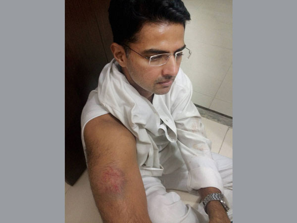 Sachin Pilot injured in clash Sachin Pilot injured in clash