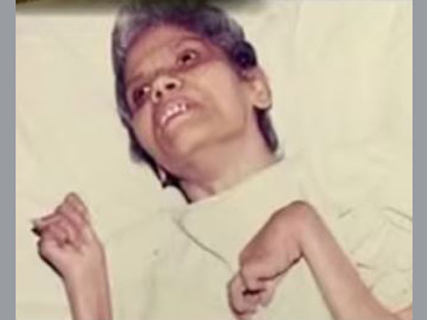 Aruna Shanbaug Aruna Shanbaug