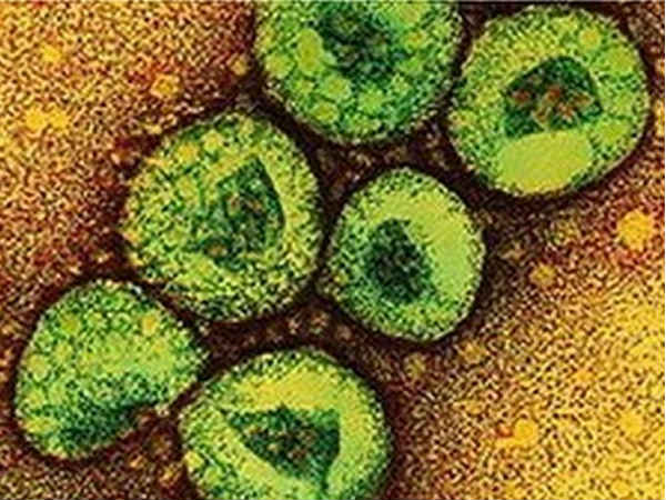 virus virus