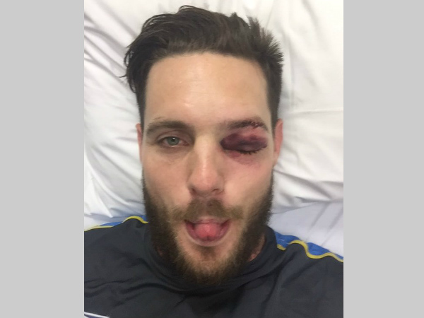 McClenaghan tweeted this picture after his injury McClenaghan tweeted this picture after his injury