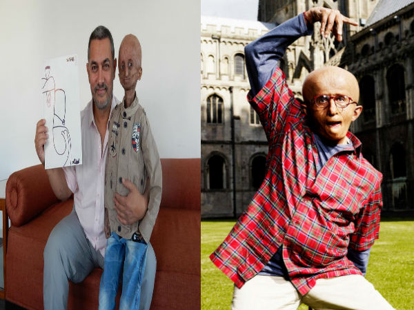 Nihal Batla suffering from progeria dies Nihal Batla suffering from progeria dies