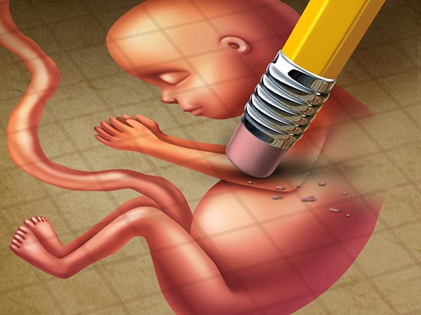 abortion abortion