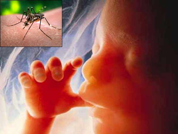 zika zika