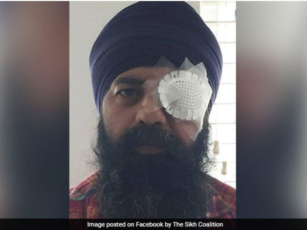 US: Sikh techie brutally assaulted US: Sikh techie brutally assaulted