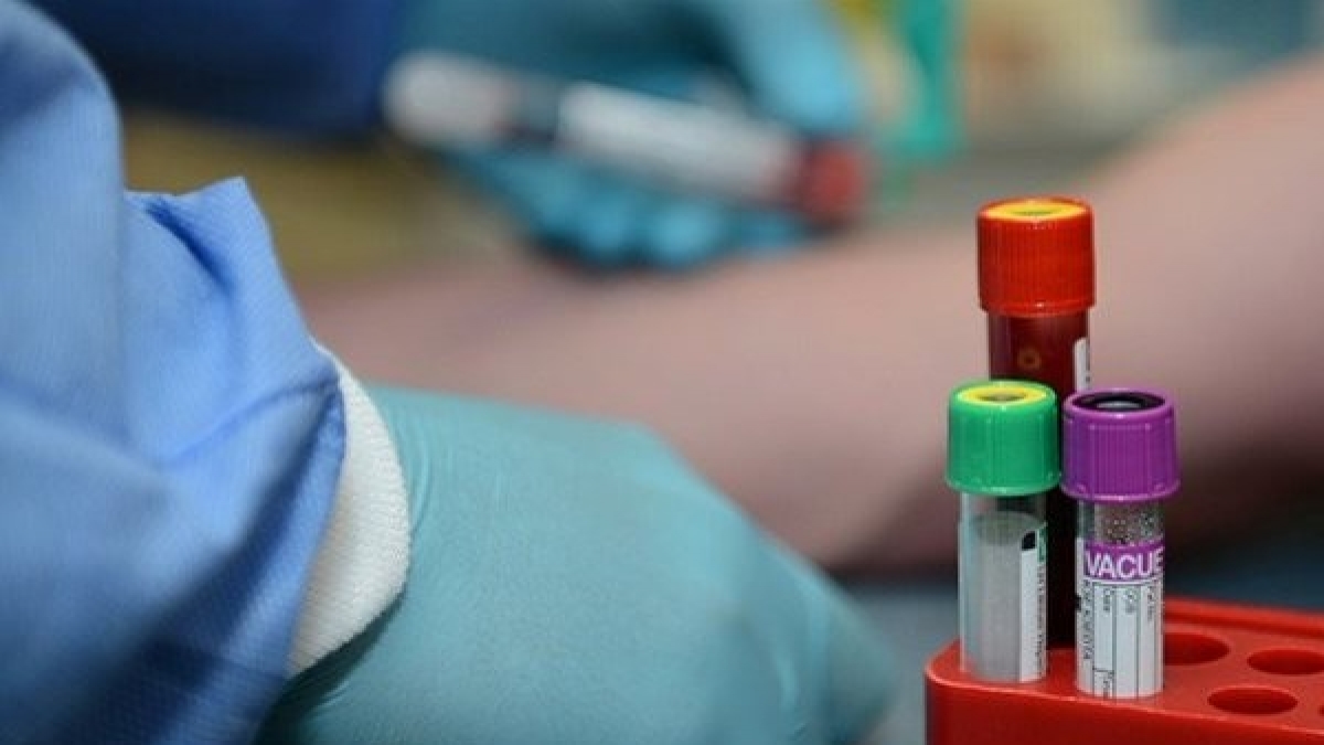 IIT Kharagpur researchers develop lowcost blood test device Oneindia News IIT Kharagpur researchers develop lowcost blood test device Oneindia News