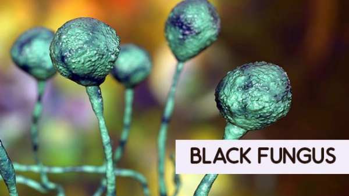 Black Fungus Cases Among Covid Patients Rise In Bengaluru K Taka Govt Seeks Details About Oneindia News Black Fungus Cases Among Covid Patients Rise In Bengaluru K Taka Govt Seeks Details About Oneindia News