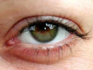 eye eye