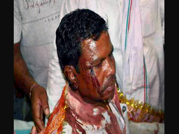 Chhattisgarh Naxal Attack