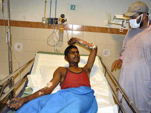 AP bus mishap: One survivor critical