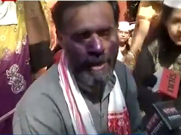 Yogendra Yadav's face smeared by ink Yogendra Yadav's face smeared by ink