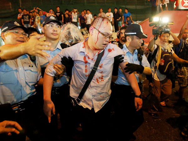 HK police arrest 19 at protest site