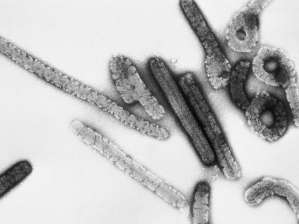 UN gears up to face Marburg fever now