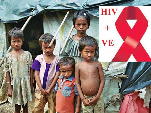 HIV HIV