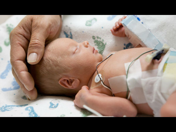 Baby: Representational Image Baby: Representational Image