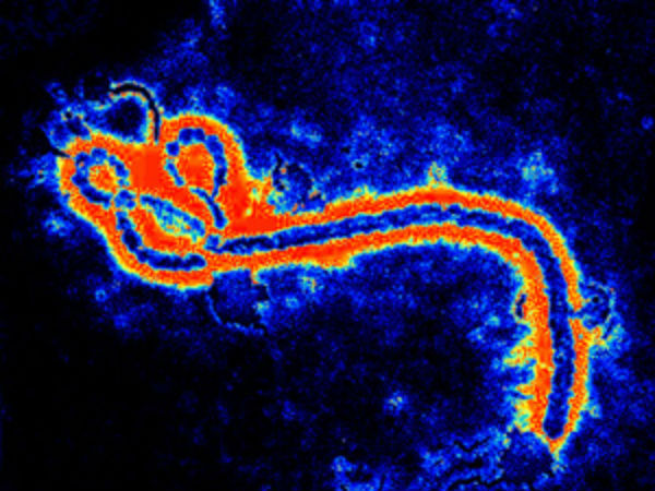 Ebola virus may cause disease in humans Ebola virus may cause disease in humans