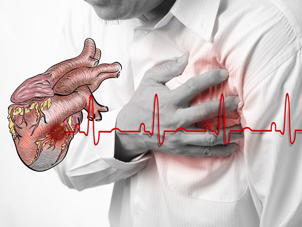What are Cardio-Vascular Diseases (CVD)?