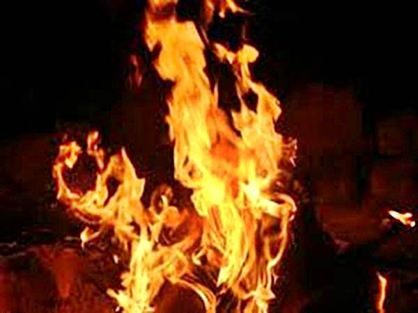 2 minor girls succumb to burn injuries 2 minor girls succumb to burn injuries