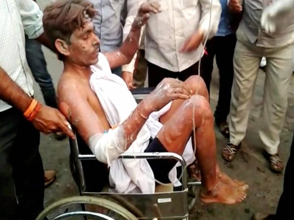 Injured labourer