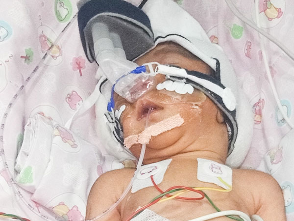 Driver’s premature baby girl waits for treatment in NICU Driver’s premature baby girl waits for treatment in NICU