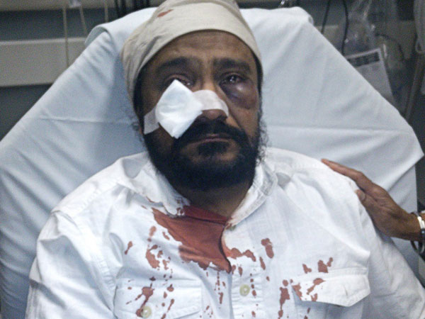 Go back to your country, Sikh man in US told after he was beaten up Go back to your country, Sikh man in US told after he was beaten up