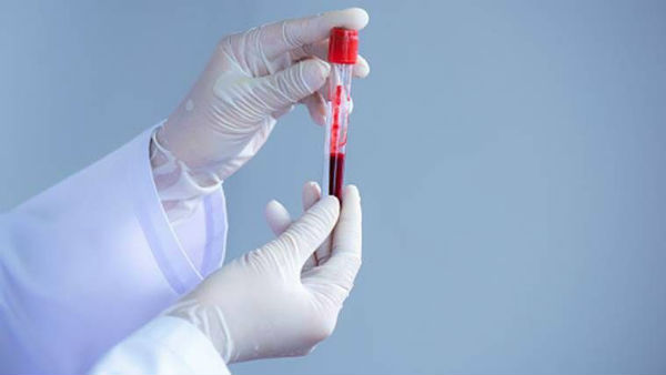 COVID-19: India in final stages of framing protocols for clinical trial of plasma therapy COVID-19: India in final stages of framing protocols for clinical trial of plasma therapy