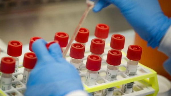 3 more Army personnel test positive for COVID-19 in Arunachal 3 more Army personnel test positive for COVID-19 in Arunachal