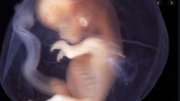 Human embryos exports allowed with condition: DGFT Human embryos exports allowed with condition: DGFT