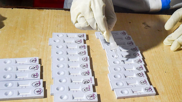 ICMR advisory on Feluda paper strip test ICMR advisory on Feluda paper strip test