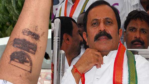 Cong leader says Covid stamp at airport caused skin burns; Puri responds Cong leader says Covid stamp at airport caused skin burns; Puri responds