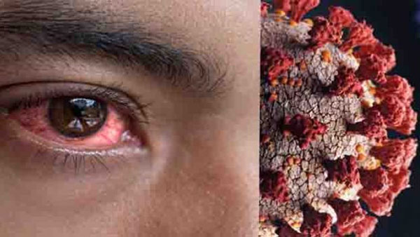 Mangaluru Seven Patients At Kmc Hospital Manipal Have Black Fungus Oneindia News