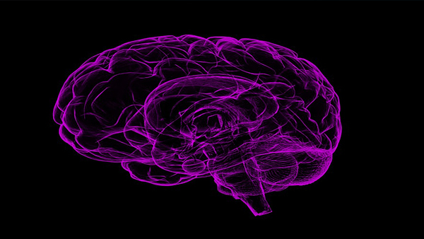 Alzheimers Alzheimers