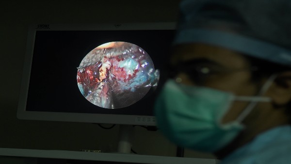 Maharashtra govt caps mucormycosis treatment rates for pvt hospitals Maharashtra govt caps mucormycosis treatment rates for pvt hospitals