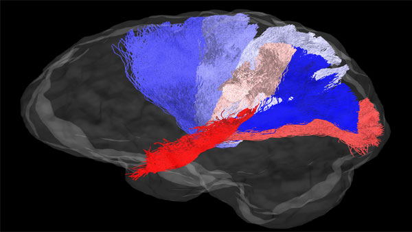 The image shows connections between the midbrain and various regions of the neocortex. Connections to each region are shown in a different colour, and were all estimated with diffusion MRI and tractography in the living human brain (Credits: Varsha Sreenivasan and Devarajan Sridharan) The image shows connections between the midbrain and various regions of the neocortex. Connections to each region are shown in a different colour, and were all estimated with diffusion MRI and tractography in the living human brain (Credits: Varsha Sreenivasan and Devarajan Sridharan)