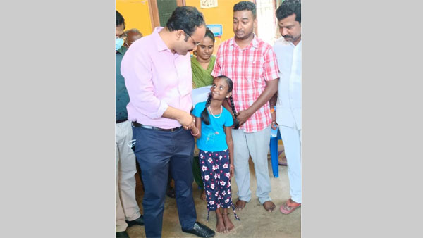 TN Govt Promises Free Treatment to Girl with Rare Facial Disfigurement Disease! TN Govt Promises Free Treatment to Girl with Rare Facial Disfigurement Disease!