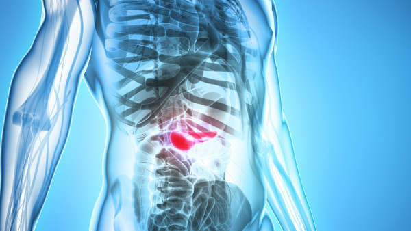 Most pancreatic cancer diagnosed too late to be cured: Study Most pancreatic cancer diagnosed too late to be cured: Study