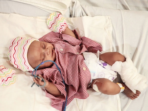 Daksh’s Heart Is Not Able To Pump Blood, Need Rs 6 Lakh For Surgery